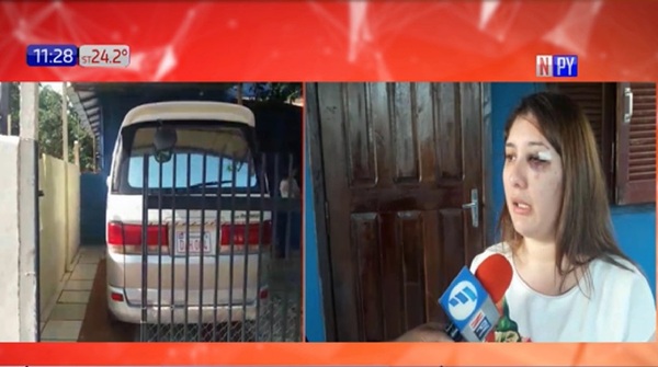 «No hay nada que denunciar», dijeron a mujer golpeada tras intento de asalto | Noticias Paraguay