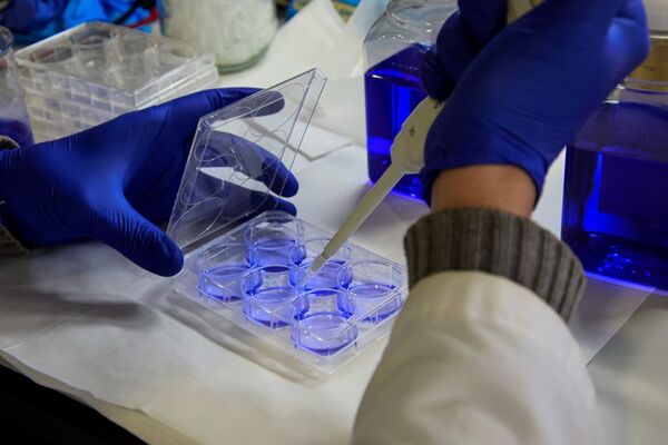 Nueva terapia con “resultados prometedores” para un cáncer cerebral infantil - Ciencia - ABC Color
