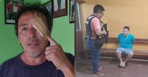 Diario HOY | Vecino atacado revela el lado violento del hermano de supuestas matricidas