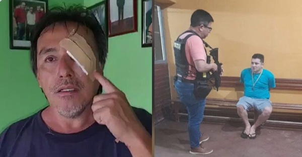 Diario HOY | Vecino atacado revela el lado violento del hermano de supuestas matricidas