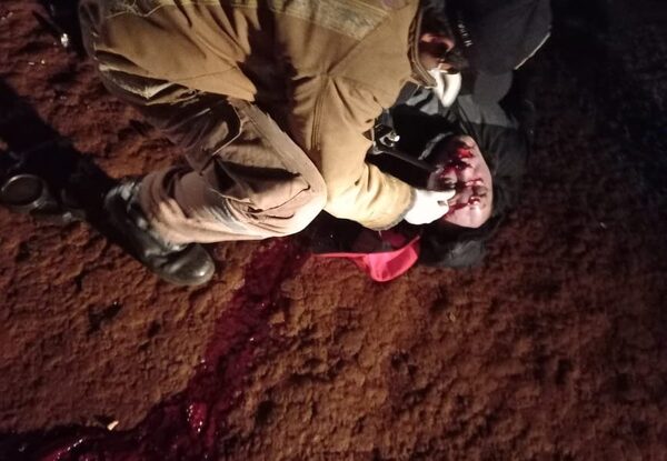 Choque frontal de motocicletas deja un fallecido y otro con heridas graves – Diario TNPRESS