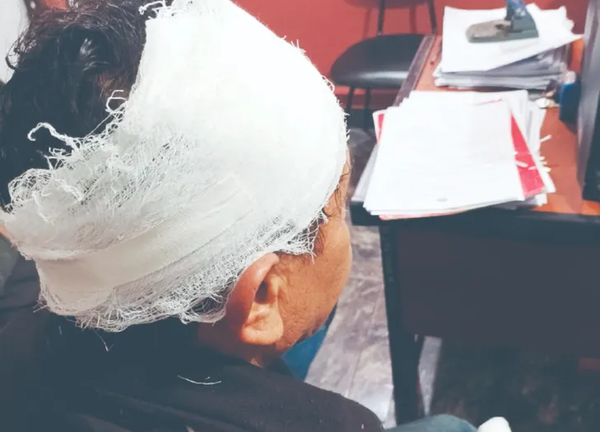 Hermanos casi se matan a golpes por tortillas - Noticiero Paraguay