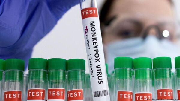Alemania registra más de 2.000 casos de viruela del mono