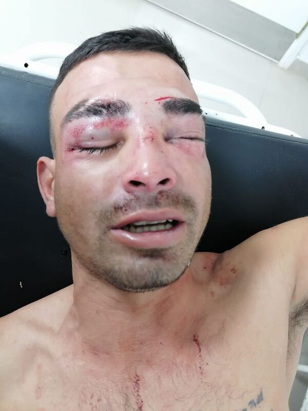 Denuncian brutal golpiza a un joven en Bahía Negra - Policiales - ABC Color