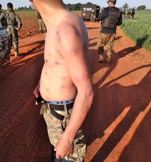 Tembiaporã: Supuestos sintierras atacaron y ocuparon predio ya desalojado previamente - Policiales - ABC Color