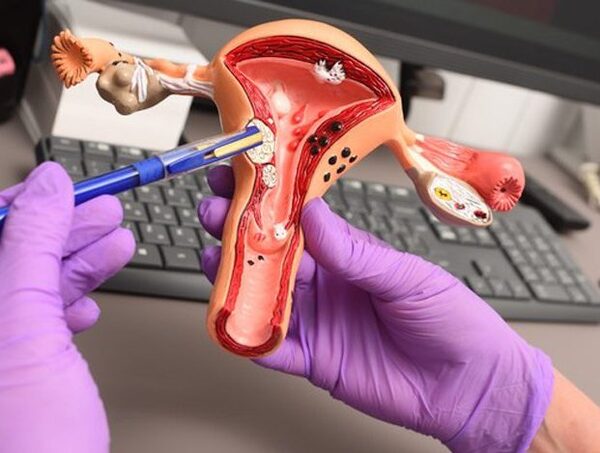 Oncólogo pide promover la educación sexual en escuelas para prevenir el cáncer uterino · Radio Monumental 1080 AM