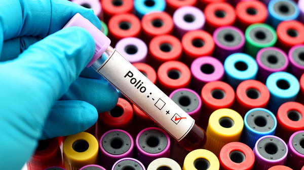 Diario HOY | Nueva York confirma el primer caso de polio en casi una década