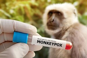 México confirma 55 casos de viruela del mono y amplía medidas preventivas - Mundo - ABC Color