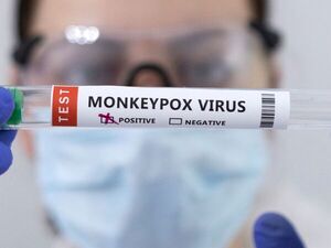 Diario HOY | Con 3.100 contagios, España es el país con más casos de viruela del mono