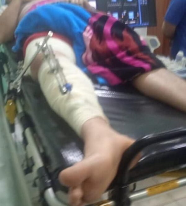 Conductor alcoholizado no asiste a motociclista que chocó y fracturó – Diario TNPRESS