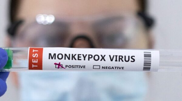 Con 3.100 contagios, España es el país con más casos de viruela del mono