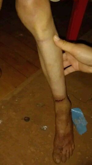 Niña desnutrida que vivía atada se escapa y busca refugio en lo de una vecina - Policiales - ABC Color
