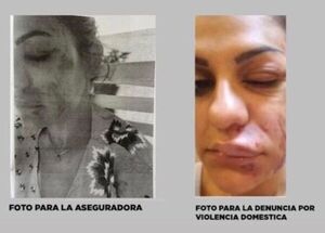 Luque: desestiman causa de supuesta violencia familiar y procesan a una mujer y a un médico por denuncia falsa y otros hechos - Nacionales - ABC Color