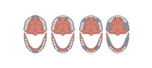 Los dientes - Escolar - ABC Color