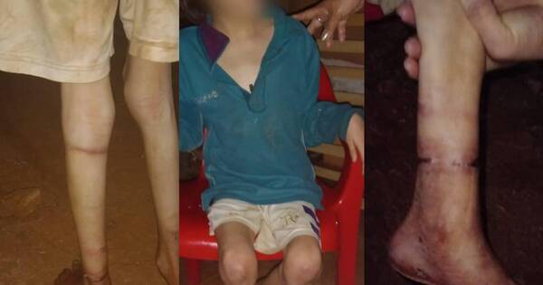 La Nación / Villa del Rosario: rescatan a niña con signos de desnutrición que era amarrada por su madre