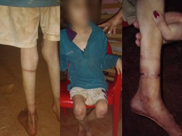 Inhumano: atada y desnutrida, niña es rescatada de su madre