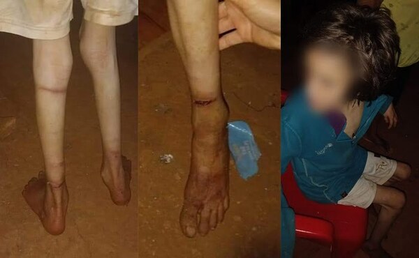 Niña desnutrida que vivía atada se escapa y busca refugio en lo de una vecina - Noticiero Paraguay