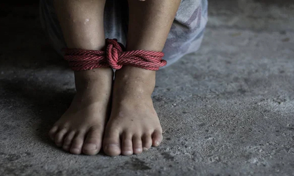¡La tenían como animal! Denuncian que una adolescente con discapacidad era atada en su casa - OviedoPress