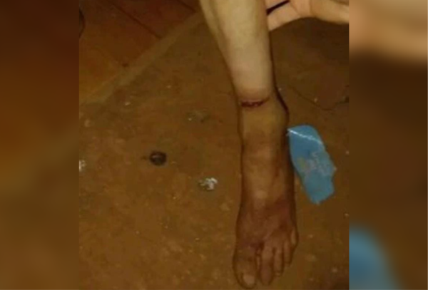 Imputarán a mujer que presuntamente tenía atada a su hija de 13 años en Villa del Rosario - Megacadena — Últimas Noticias de Paraguay