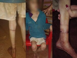Investigan situación de una niña de 13 años severamente desnutrida · Radio Monumental 1080 AM