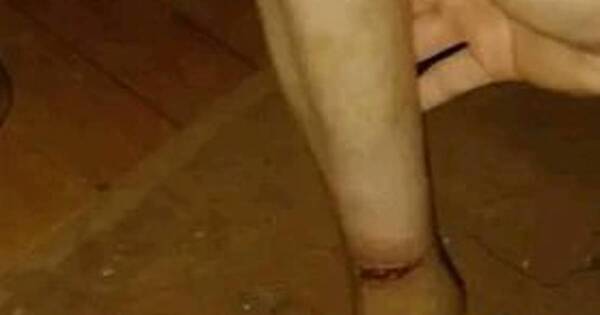 La Nación / Imputarán a madre de niña de 13 años rescatada por sufrir maltrato y presentar desnutrición severa