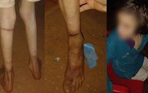 Niña desnutrida que vivía atada se escapa y busca refugio en lo de una vecina en Villa del Rosario – Prensa 5