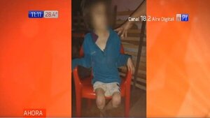 ¡Extrema crueldad! Hallan a una niña con severa desnutrición y signos de maltrato | Noticias Paraguay
