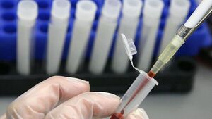 Primer caso mundial de control del VIH sin tratamiento durante 15 años