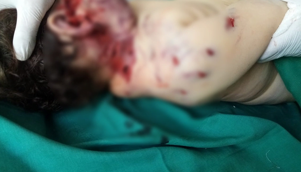 Fiscalía sugiere trasladar a la Morgue el cuerpo del niño fallecido por ataque de perro - Noticiero Paraguay