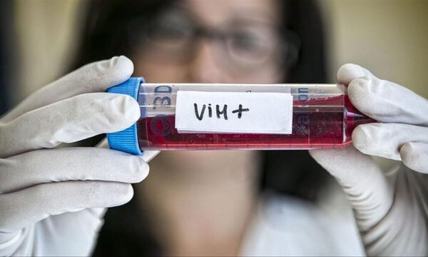 Primer caso mundial de control del VIH sin tratamiento durante 15 años