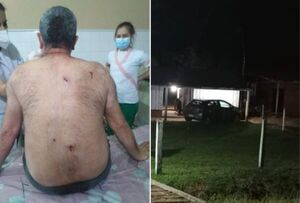 Grupo criminal atentó contra un docente, quien logró sobrevivir pero está grave