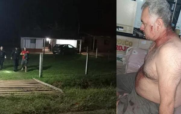 Intentaron asesinar a tiros a un docente en Itapúa – Prensa 5