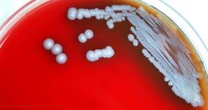 La Nación / EEUU: encuentran bacterias de una rara enfermedad en suelo y agua