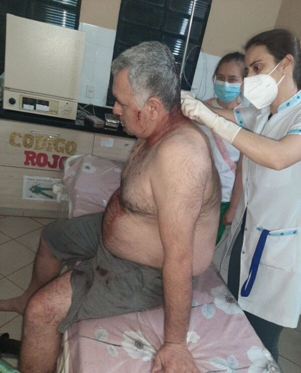Diario HOY | Banda que asalta y viola, le aplica 6 balazos a un hombre, por hablar en celular