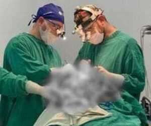 Doña fue a consultar por un dolor de cabeza y le operaron porque tenía un tumor