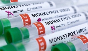 España reportó el segundo fallecimiento por viruela del mono - Megacadena — Últimas Noticias de Paraguay