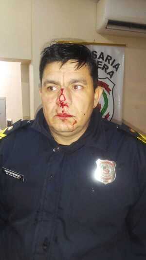 Hombre sup. golpeó y dejó inconsciente a un policía