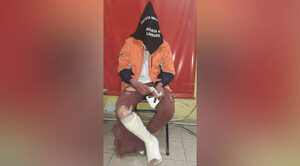 Joven con orden de captura se fracturó la pierna cuando escapaba de la Policía
