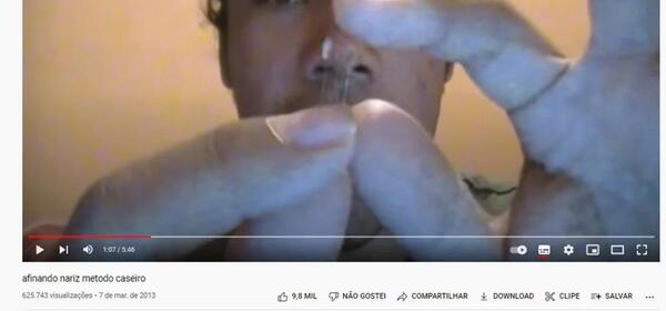 Increíble: decidió hacerse su propia rinoplastia y terminó en el hospital
