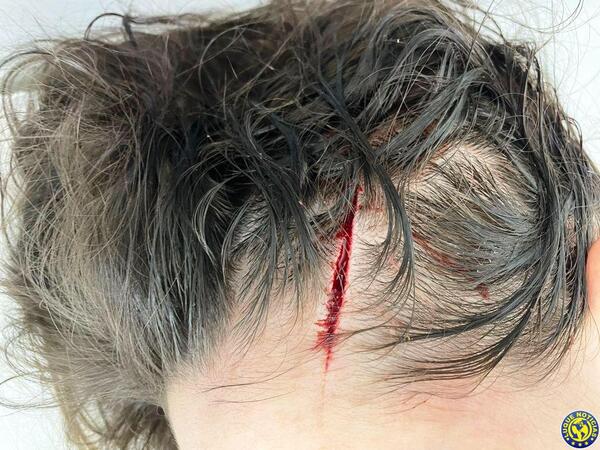 Motochorros asaltan y hieren con machetillo a una joven Luque •