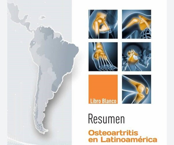 Lanzan Libro Blanco sobre la Osteoartritis en Latinoamérica | 1000 Noticias