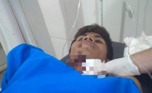 Santa Rita: Casi degüellan a indígena