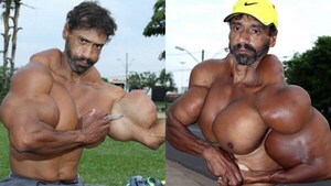 Murió el Hulk brasileño: se inyectó aceite durante años para aumentar sus músculos