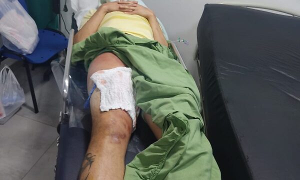 Hombre con prohibición de salida del país fue baleado en Brasil