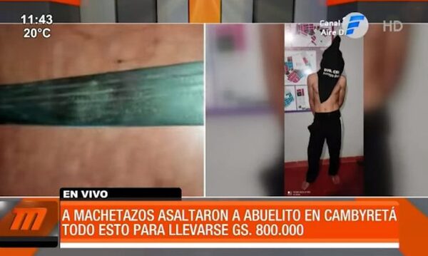 A machetazos asaltaron a abuelito en Cambyretá | Telefuturo