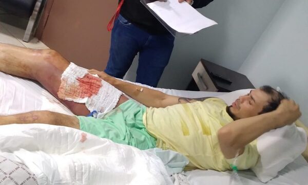 Balean a un hombre en Lago Itaipú, en zona de Pikyry, e investigan circunstancias – Diario TNPRESS