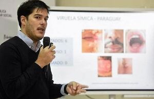 Alto Paraná registra un caso sospechoso  de viruela del mono | DIARIO PRIMERA PLANA