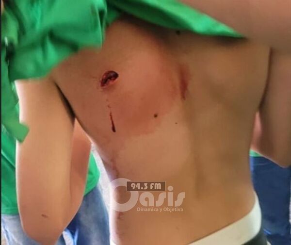Estudiante de escuela de Ponta Porã fue apuñalado tras pelea entre alumnos