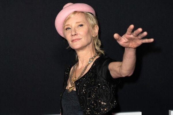 Actriz Anne Heche en estado crítico tras un accidente de coche, según medios - Gente - ABC Color