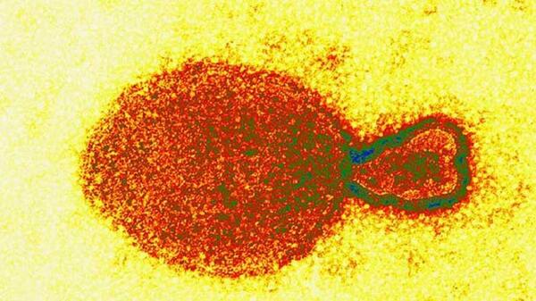 Detectan en China nuevo virus de origen animal | 1000 Noticias